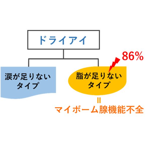 CS眼科-ドライアイ